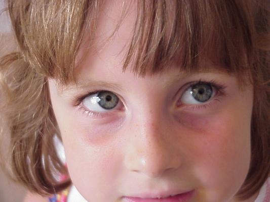 These eyes